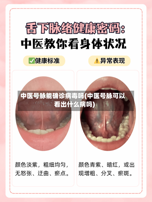 中医号脉能确诊病毒吗(中医号脉可以看出什么病吗)-第2张图片