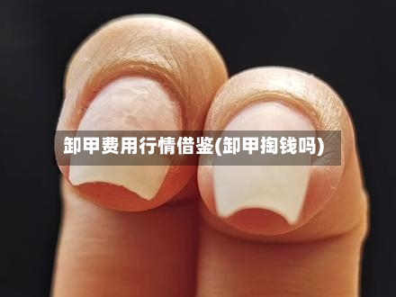 卸甲费用行情借鉴(卸甲掏钱吗)-第3张图片