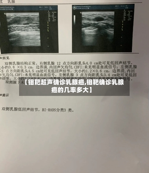 【钼靶超声确诊乳腺癌,钼靶确诊乳腺癌的几率多大】