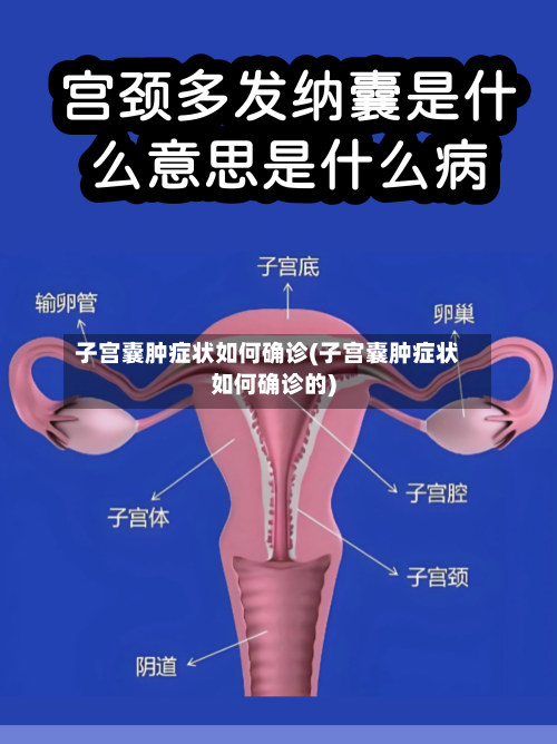 子宫囊肿症状如何确诊(子宫囊肿症状如何确诊的)-第2张图片