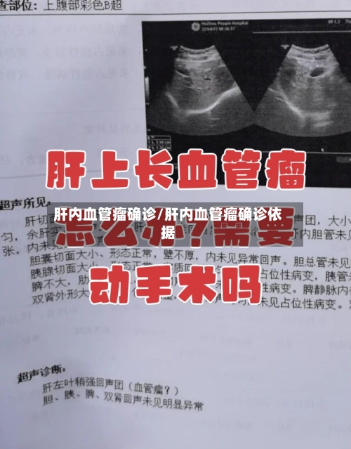 肝内血管瘤确诊/肝内血管瘤确诊依据